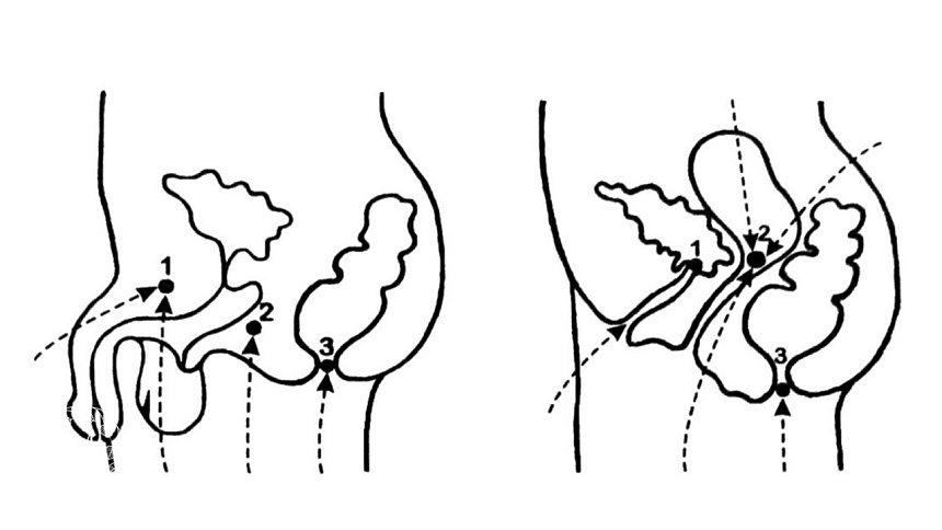 Мула-бандха фото